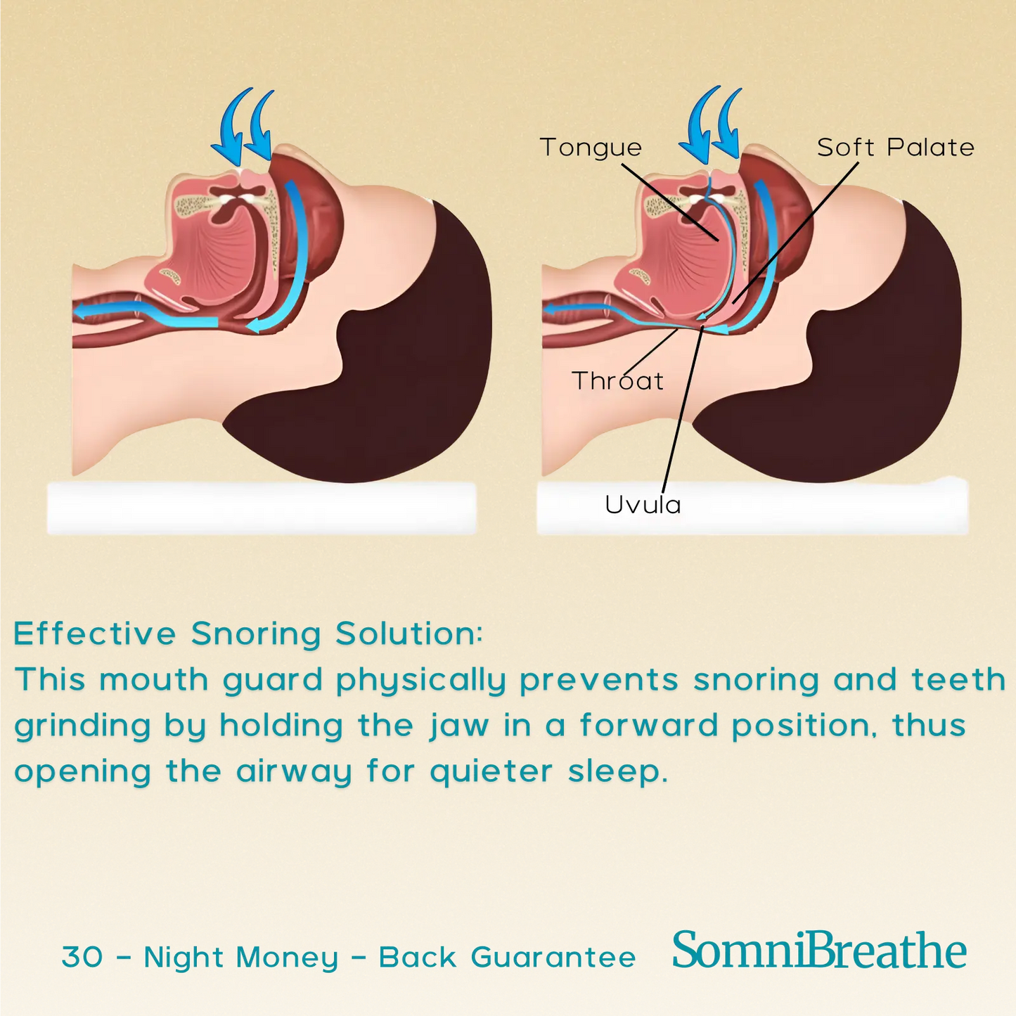 Adjustable Anti-Snore Mouth Guard – Reduce Snoring & Protect Teeth