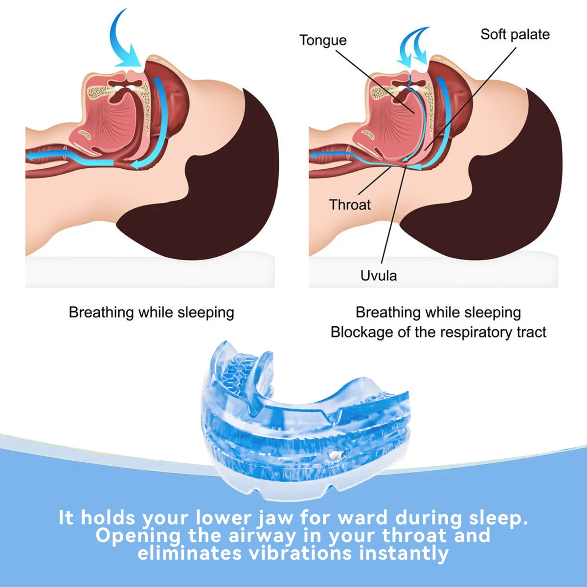 Anti Snore Mouth Guard for Bruxism and Sleep Apnea Relief