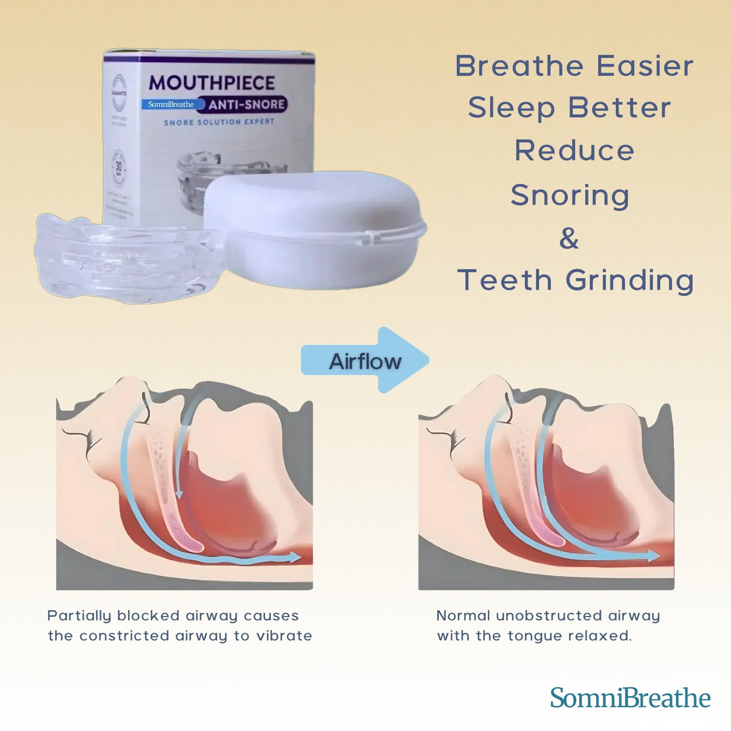 SomniBreathe Anti-Snoring & Teeth Grinding Mouth Guard – Comfortable Silicone Mouthpiece for Peaceful Sleep