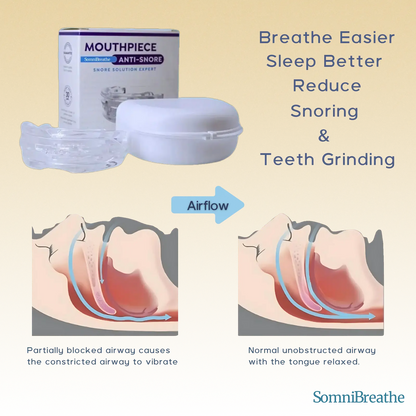 SomniBreathe Anti-Snoring & Teeth Grinding Mouth Guard – Comfortable Silicone Mouthpiece for Peaceful Sleep