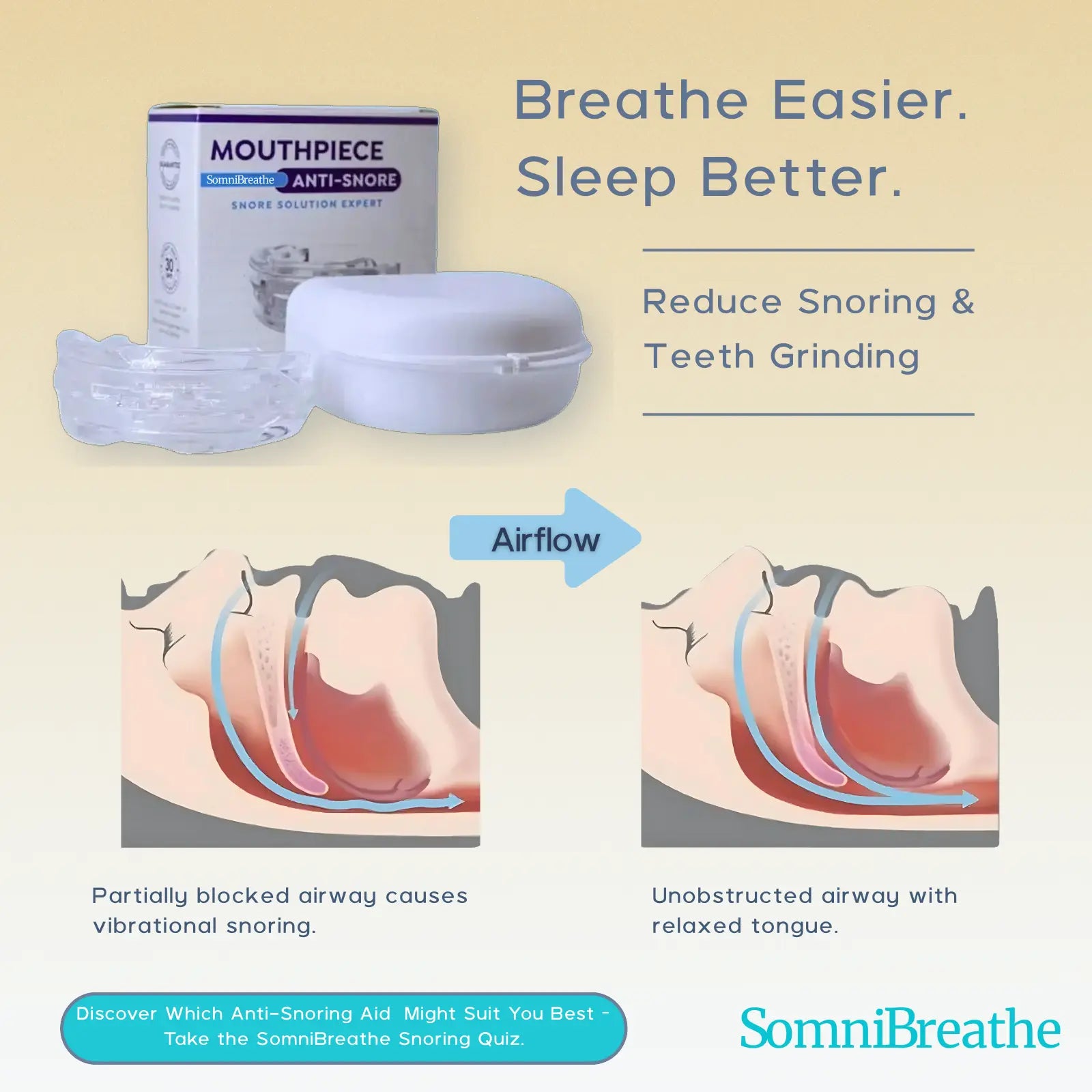 SomniBreathe Anti-Snoring & Teeth Grinding Mouth Guard – Comfortable Silicone Mouthpiece for Peaceful Sleep SomniBreathe